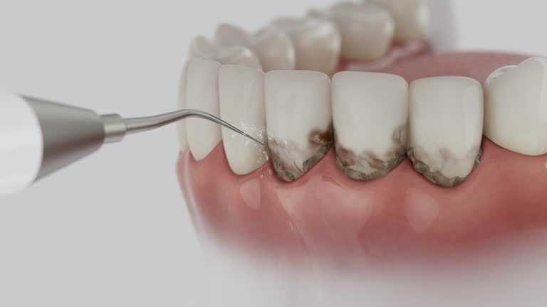 Trusted Tooth Extraction service in Kernersville, NC - Dentist Open Now
